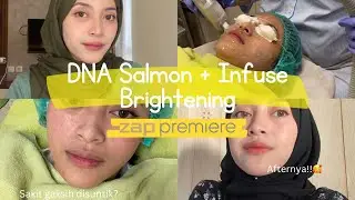 COBAIN TREATMENT DNA SALMON + INFUSE BRIGHTENING DI ZAP CLINIC!🤍✨ Gimana hasilnya?