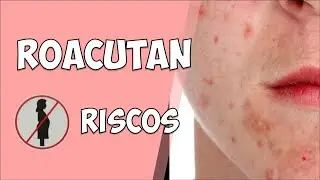 ROACUTAN: cuidado antes de usar! | COSMÉTICOS #77