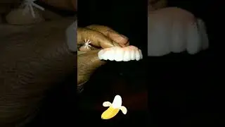 Thermoplastic Fake teeth 🍎