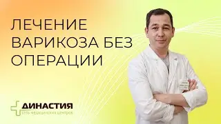 Лечение варикоза без операции