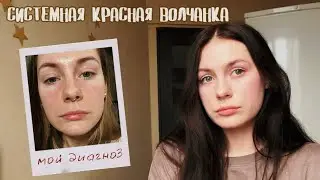 Системная красная волчанка | моя история, как я узнала о заболевании
