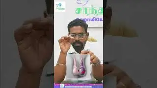 Manual detorsion of the testis is an easy maneuver done without anesthesia/Testicular Torsion