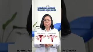 Waspadai Ciri-ciri Hamil Anggur ya, Bumil!