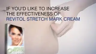 Revitol Stretch Mark Cream Reviews