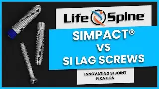 SIMPACT vs SI Lag Screws
