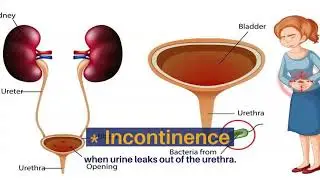 The Common Problems of the Urinary System - The Life Plus Hospital