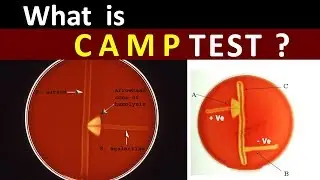 Why & What is CAMP  Test ?  ( Clear Explain )