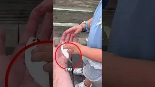 un pato atacó a una chica