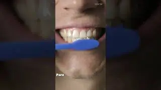 Lavado de dientes
