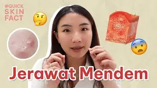 Jerawat Mendem | October Quick Skin Fact #funskintalk