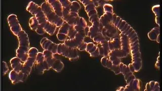 What Can Be Seen in a Typical Live Blood Analysis Appointment - Live Blood Analysis Training Course