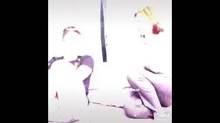 💞Самый красивый мальчик на свете💞 #брайнмапс