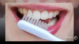отбеливание зубов отзывы   - Как сделать зубы белее