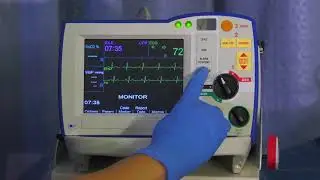 R Series Monitoring - v14