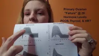Ovarian Failure, PCOS, HRT, Thyroid & My Hormones