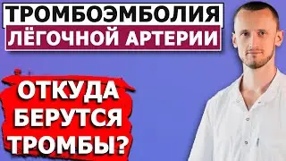 ТРОМБОЭМБОЛИЯ ЛЁГОЧНОЙ АРТЕРИИ | ТЭЛА