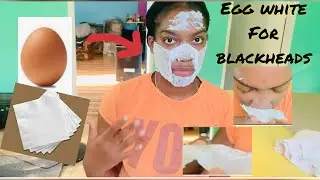 DIY Blackhead Peel Off Mask With An Egg/It ACTUALLY WORKS!!