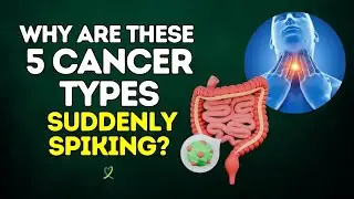 Why These 5 Cancers Are on the Rise