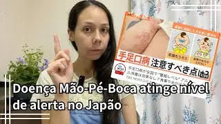 Doença Mão-Pé-Boca atinge nível de alerta no Japão
