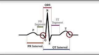 Electrocardiogram Waves (P-QRS-T Waves) - MEDZCOOL