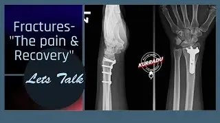 Bones And Relations - They hurt a lot when broken | MSK Telugu Podcast