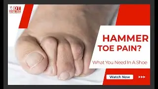 Best Shoes For Hammertoe Pain Relief