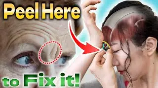 Peel This Muscle, then Frown Lines and Forehead Wrinkles will be Removed without Botox