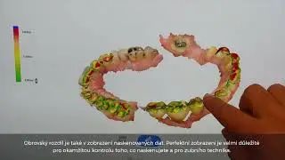 Jak vybírat intraorální skener