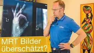 Werden MRT Bilder überschätzt ❓Bildgebende Verfahren zur Diagnose ✅