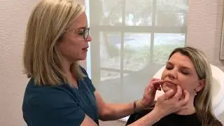 What are different options for filling and volumizing the face?