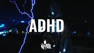 [FREE] VKIE TYPE BEAT 2025 - 