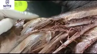 Demonstration ofaxillary artery