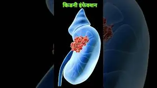 sardiyon mein bar bar peshab aana | bar bar peshab aana | #short video
