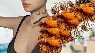 ASMR Remove Dog Ticks & Worm Infected Armpit | Severely Injured Animation
