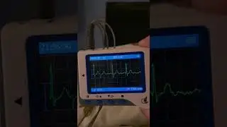 Female heart, breathplay, irregular heartbeat