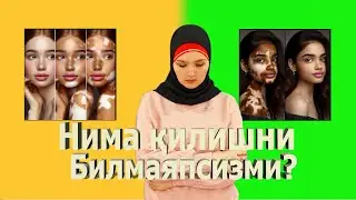Витилигодан азоб чекяпсизми? | Vitiligodan azob chekyapsizmi?