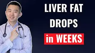 The FASTEST Way to Reverse Fatty Liver, Naturally | NAFLD Treatment