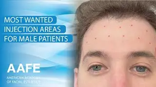 Most Wanted Injection Areas for Male Patients
