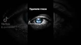 а вы знали? учёные удалили глаза