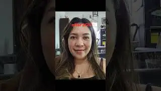 Melasma journey
