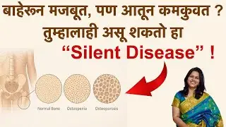 बाहेरून मजबूत, पण आतून कमकुवत ? तुम्हालाहि असू शकतो हा आजार | Osteoporosis & diet Tips in Marathi