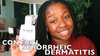 5 ways I control SEBORRHEIC DERMATITIS with LOCS