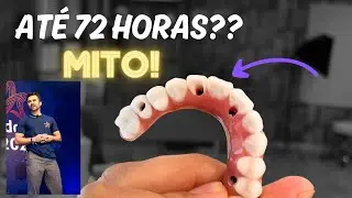 Implante Com Baixo Torque e O Medo De Mexer na Prótese - Um Mito.
