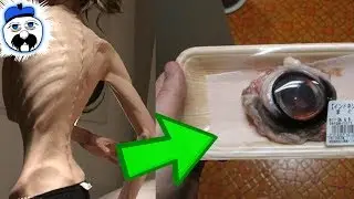 10 Dumbest Diets That Nearly Killed People