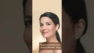 ОМОЛОЖЕНИЕ ЛИЦА