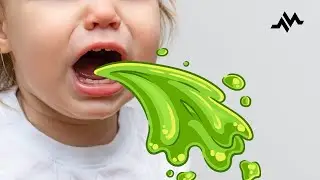 Vomiting and Fever in a 1-year-old girl - Case Report