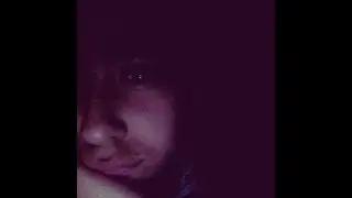 Прыщь