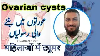 Cyts and types | Rasoli or iqsam | female cyst | Dr Qazi Fahim Shezad