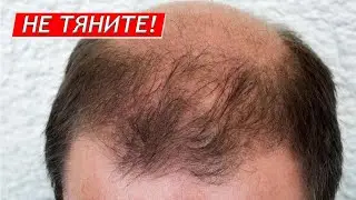 Почему выпадают волосы? Остеохондроз как причина облысения