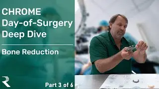 CHROME Day-of-Surgery Deep Dive: Bone Reduction (Part 3)